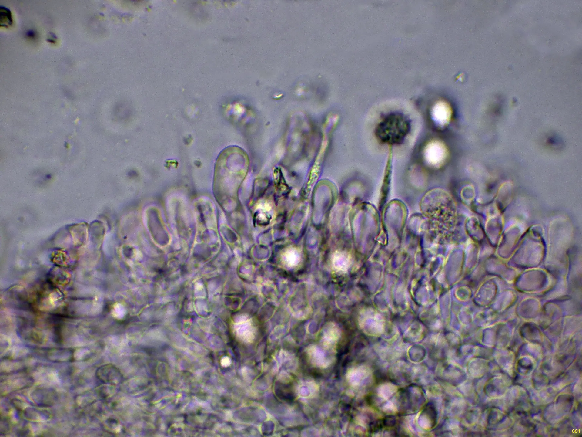 Microscopía de Lactarius tabidus - 10 - Queilocistidios-001